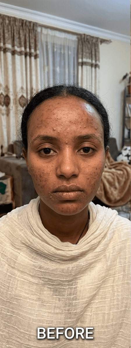 BB LAB probiotic collagen